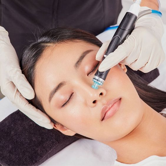 Hydrafacial