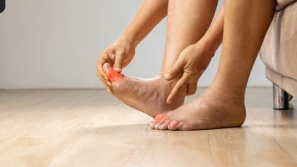 How to Control Uric Acid