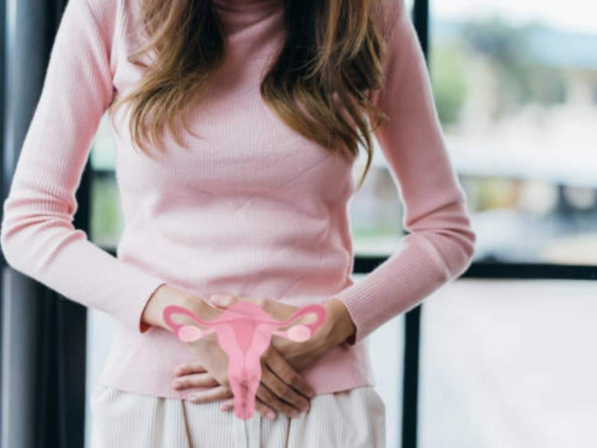 PCOS Meaning in Urdu