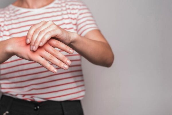 Uric Acid Symptoms