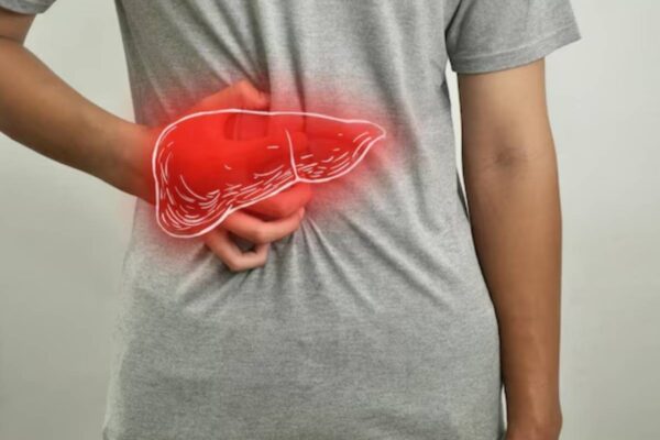 Fatty liver diet plan